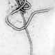 Image for article titled Why is ebola deadlier than other viruses?